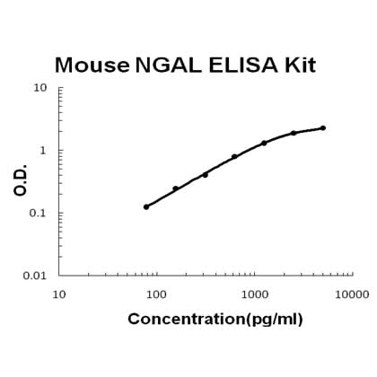 Mouse Lipocalin-2/NGAL ELISA Kit EZ-Set™ (DIY Antibody Pairs) Boster Bio