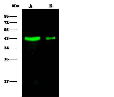 Anti-Human LRPAP1 Antibody [A1056] - ABMIUM