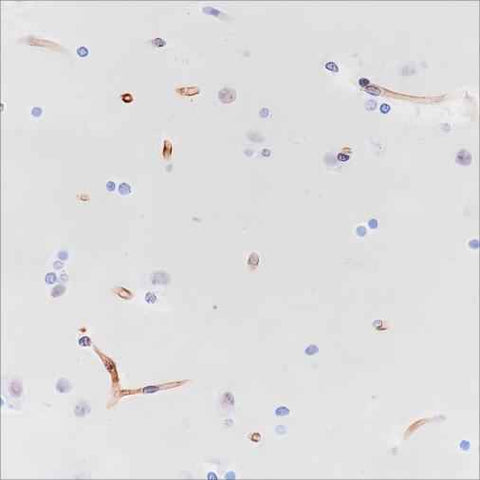 Anti-Human Nestin Antibody [A313] - ABMIUM
