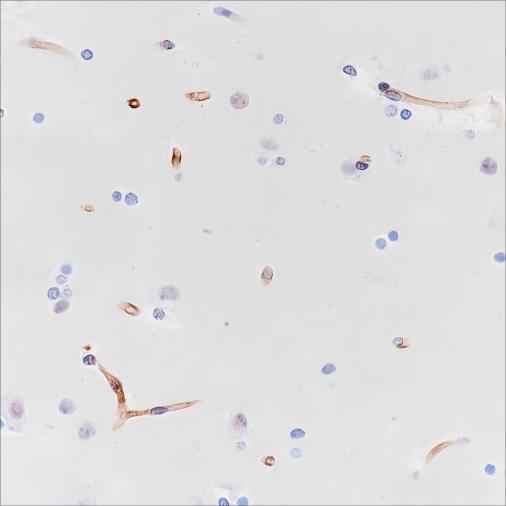Anti-Human Nestin Antibody [A313] - ABMIUM