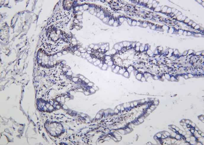 Anti-Human/Mouse/Rat IκB-α Antibody [B1043] - ABMIUM