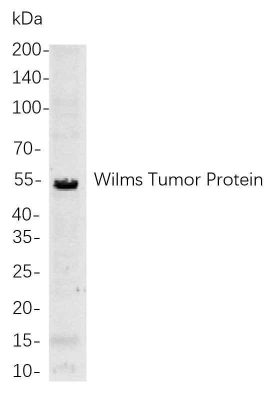 Anti-Human/Mouse/Rat Wilms Tumor Protein Antibody [B851]