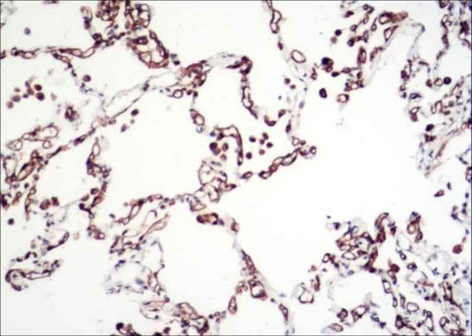 Anti-Human CA4 Antibody [B107] - ABMIUM