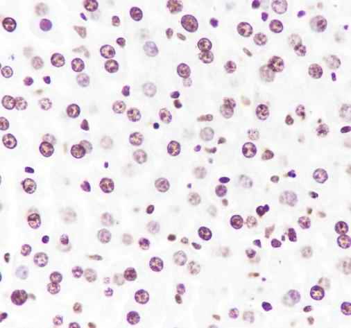 Anti-Human/Rat/Mouse/Rice Histone H3 Antibody [A416]