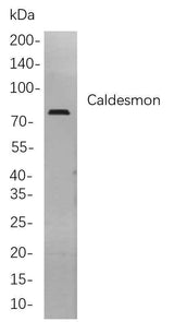 Anti-Human/Mouse/Rat Caldesmon Antibody [B840]