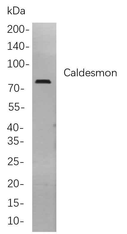 Anti-Human/Mouse/Rat Caldesmon Antibody [B840] - ABMIUM