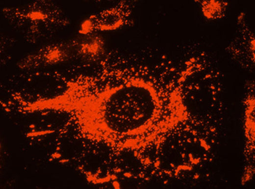EnkiLife RA20026 DeepRed live-cell fluorescence image showing lysosomal staining (manufacturer image)