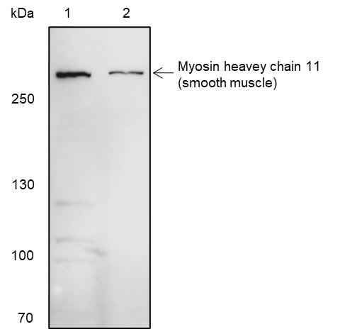 Anti-Human Smooth Muscle Myosin heavy chain 11 Antibody [A362] - ABMIUM