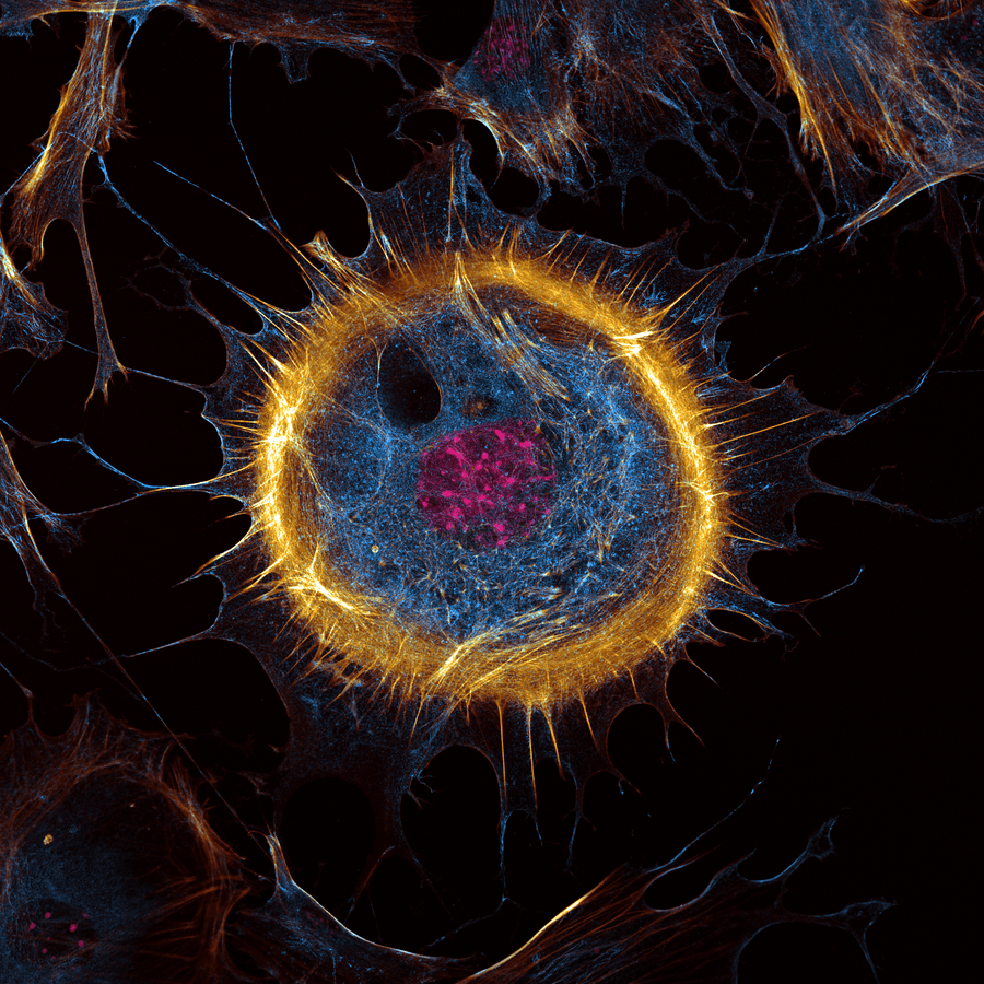 Mouse Embryonic Fibroblasts