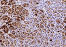 Anti-Human REG1A Antibody [A1063] - ABMIUM
