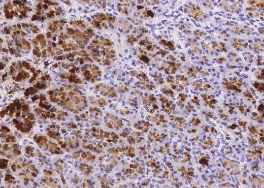 Anti-Human REG1A Antibody [A1063] - ABMIUM
