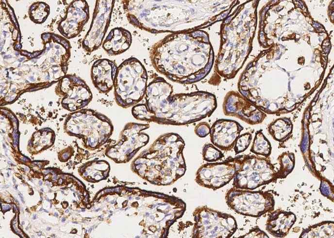 Anti-Human SLC3A2 Antibody [B345] - ABMIUM
