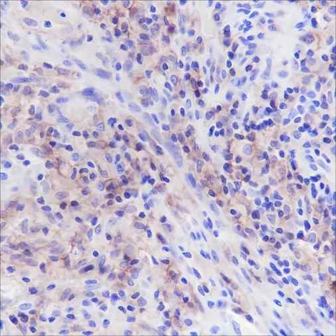 Anti-Human CD33 Antibody [A170] - ABMIUM