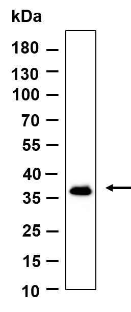 Anti-Human/Mouse/Rat OXGR1 Antibody [B976] - ABMIUM