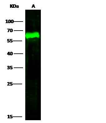 Anti-Human ARSA Antibody [A1221] - ABMIUM