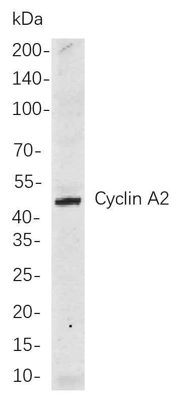 Anti-Human/Mouse/Rat Cyclin A2 Antibody [B703] - ABMIUM