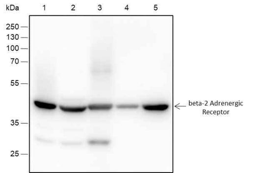 Anti-Human/Rat/Mouse beta-2 Adrenergic Receptor Antibody [A140] - ABMIUM