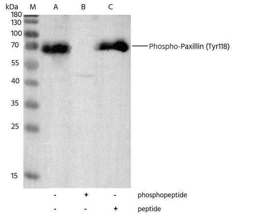 Anti-Human PXN Antibody [B310] - ABMIUM