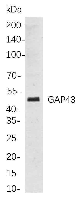 Anti-Human/Mouse/Rat GAP43 Antibody [B815] - ABMIUM