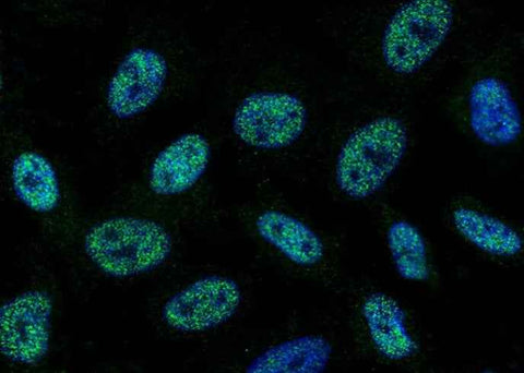 Anti-Human SAE1 Antibody [A929] - ABMIUM