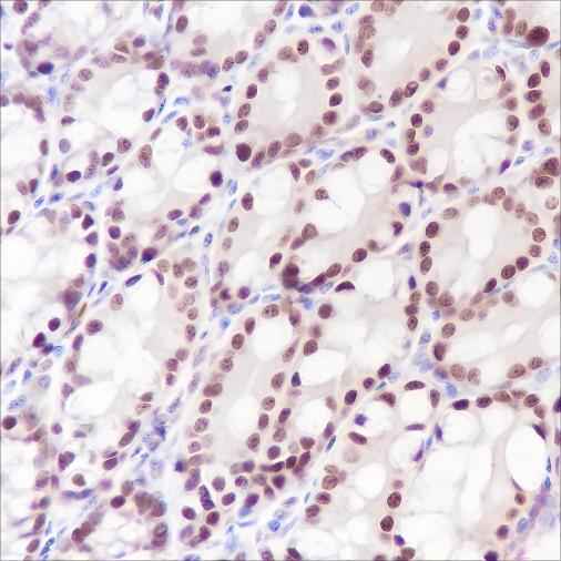 Anti-Mouse Ku80 Antibody [A283]