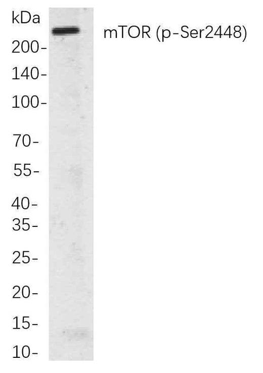 Anti-Human/Mouse/Rat mTOR Antibody [6B4] - ABMIUM