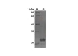 SDS-PAGE analysis of Human FGF21 proteins, 2 μg/lane of Recombinant Human FGF21 proteins was resolved with SDS-PAGE under reducing conditions, showing bands at 22 kDa.