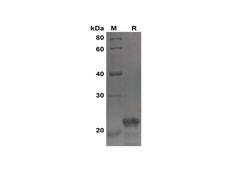 SDS-PAGE analysis of Human FGF21 proteins, 2 μg/lane of Recombinant Human FGF21 proteins was resolved with SDS-PAGE under reducing conditions, showing bands at 22 kDa.