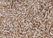 Anti-Human/Cynomolgus VEGFA Antibody [A854] - ABMIUM