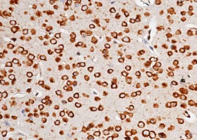 Anti-Mouse AGO2 Antibody [A1279] - ABMIUM