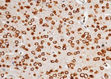 Anti-Mouse AGO2 Antibody [A1279] - ABMIUM