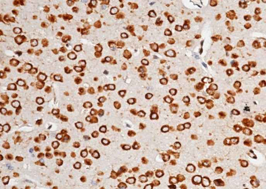 Anti-Mouse AGO2 Antibody [A1279] - ABMIUM