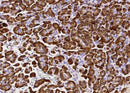 Anti-Human CPB1 Antibody [A953] - ABMIUM
