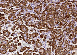 Anti-Human CPB1 Antibody [A953] - ABMIUM