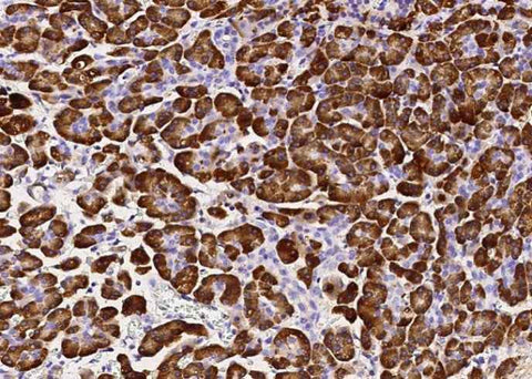 Anti-Human CPB1 Antibody [A953] - ABMIUM
