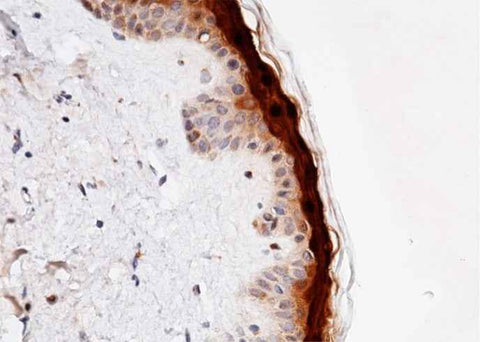Anti-Human CALML5 Antibody [B159] - ABMIUM