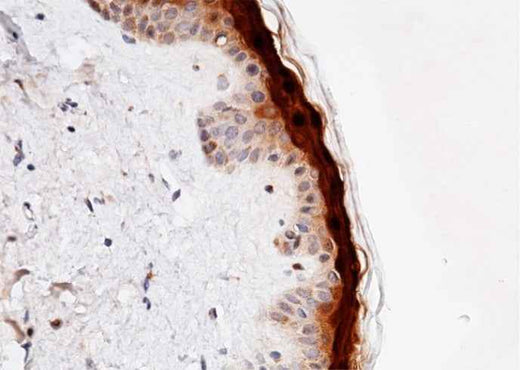 Anti-Human CALML5 Antibody [B159] - ABMIUM