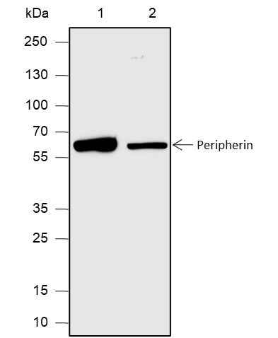 Anti-Human/Rat/Mouse Peripherin Antibody [A615] - ABMIUM