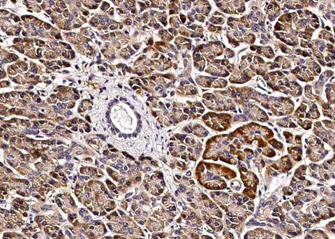Anti-Human VAPB Antibody [B120] - ABMIUM