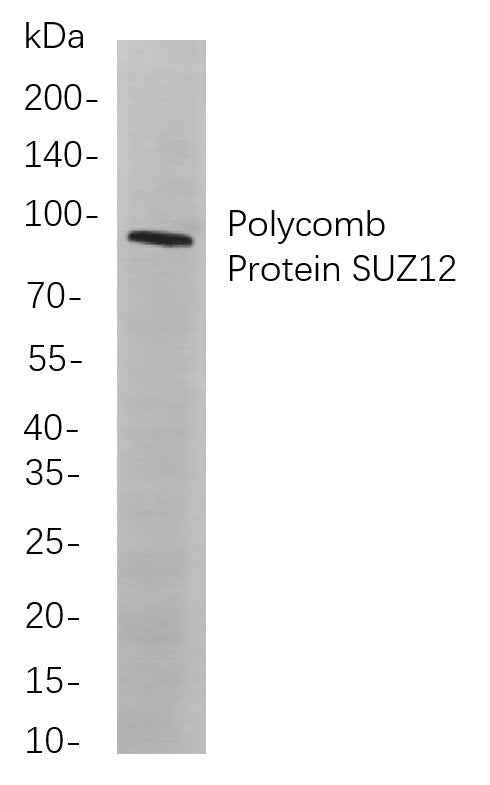 Anti-Human/Mouse/Rat Polycomb Protein SUZ12 Antibody [B804] - ABMIUM