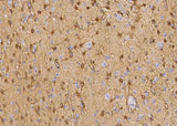 Anti-Human EZR Antibody [B355]