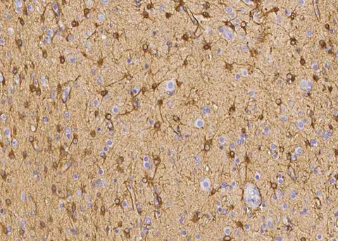 Anti-Human EZR Antibody [B355] - ABMIUM
