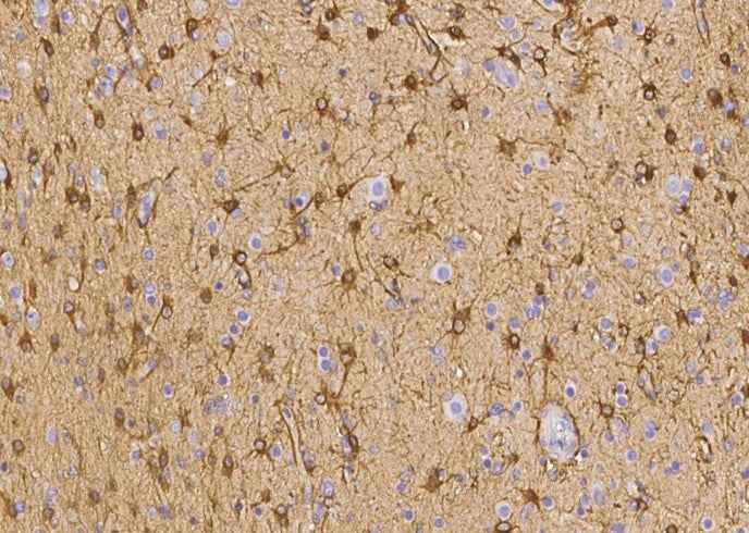 Anti-Human EZR Antibody [B355]