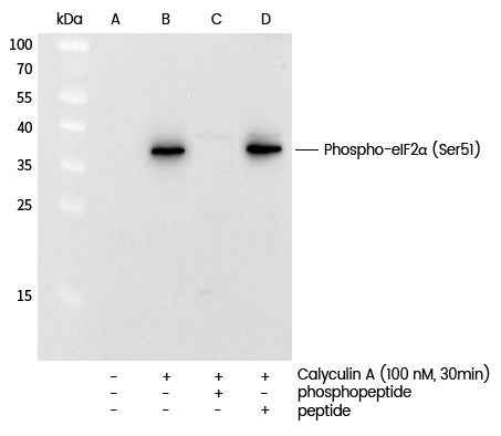 Anti-Human EIF2S1 Antibody [A1259] - ABMIUM