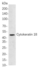 Anti-Human/Mouse/Rat Cytokeratin 18 Antibody [B709]