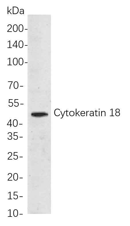 Anti-Human/Mouse/Rat Cytokeratin 18 Antibody [B709]