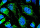 Anti-Human LUM Antibody [B332]