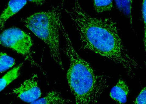 Anti-Human LUM Antibody [B332] - ABMIUM