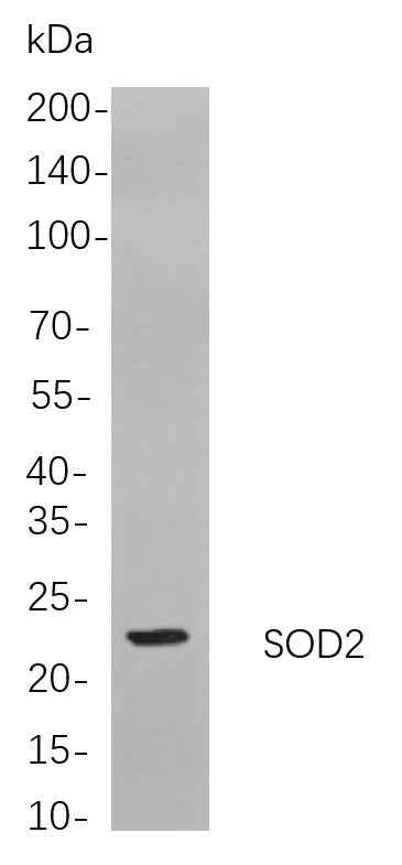 Anti-Human/Mouse/Rat SOD2 Antibody [B712] - ABMIUM