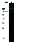Anti-Human ADAM12 Antibody [A1220] - ABMIUM